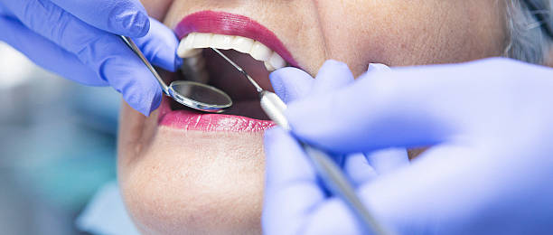 Best Knocked-Out Tooth (Avulsed Tooth) Treatment in White Mountain Lake, AZ